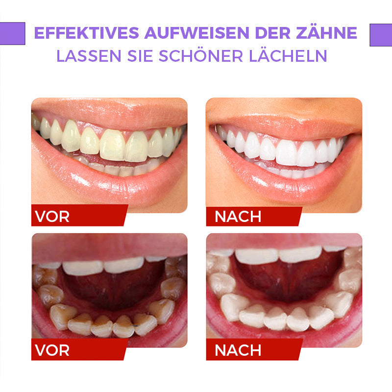 Aufhellende Zahnpasta